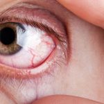 O que causa as flutuacao oculares