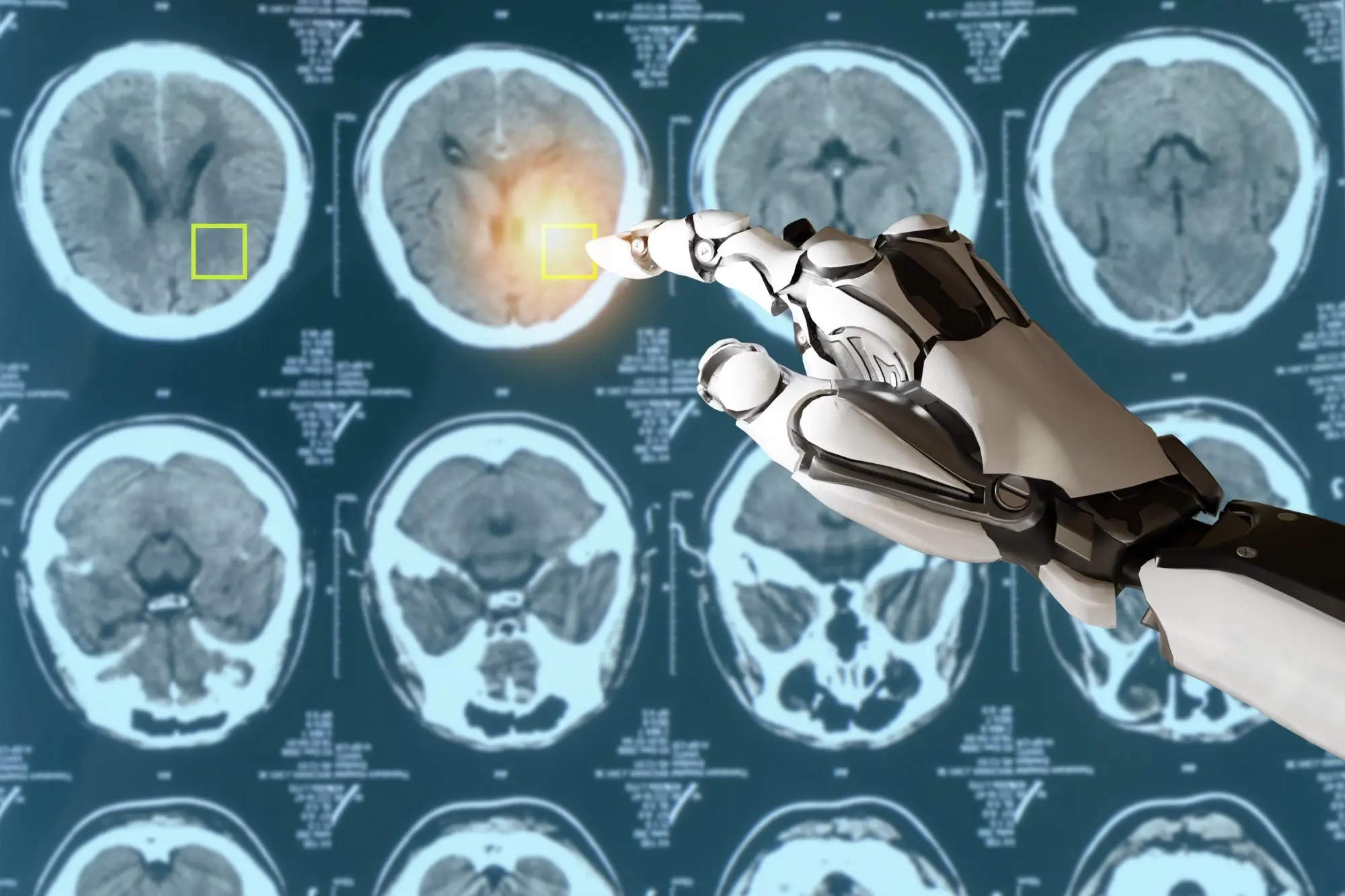 Inteligencia artificial pode detectar cancer em 30 minutos
