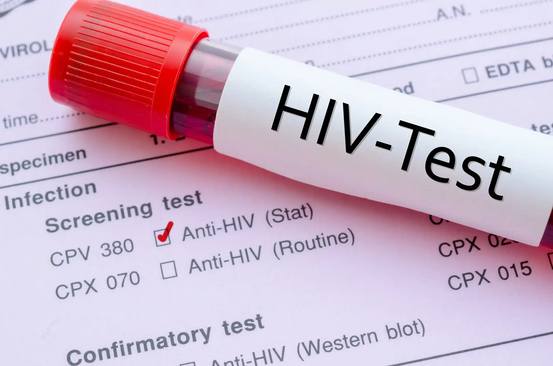 Qual e a diferenca entre HIV e AIDS