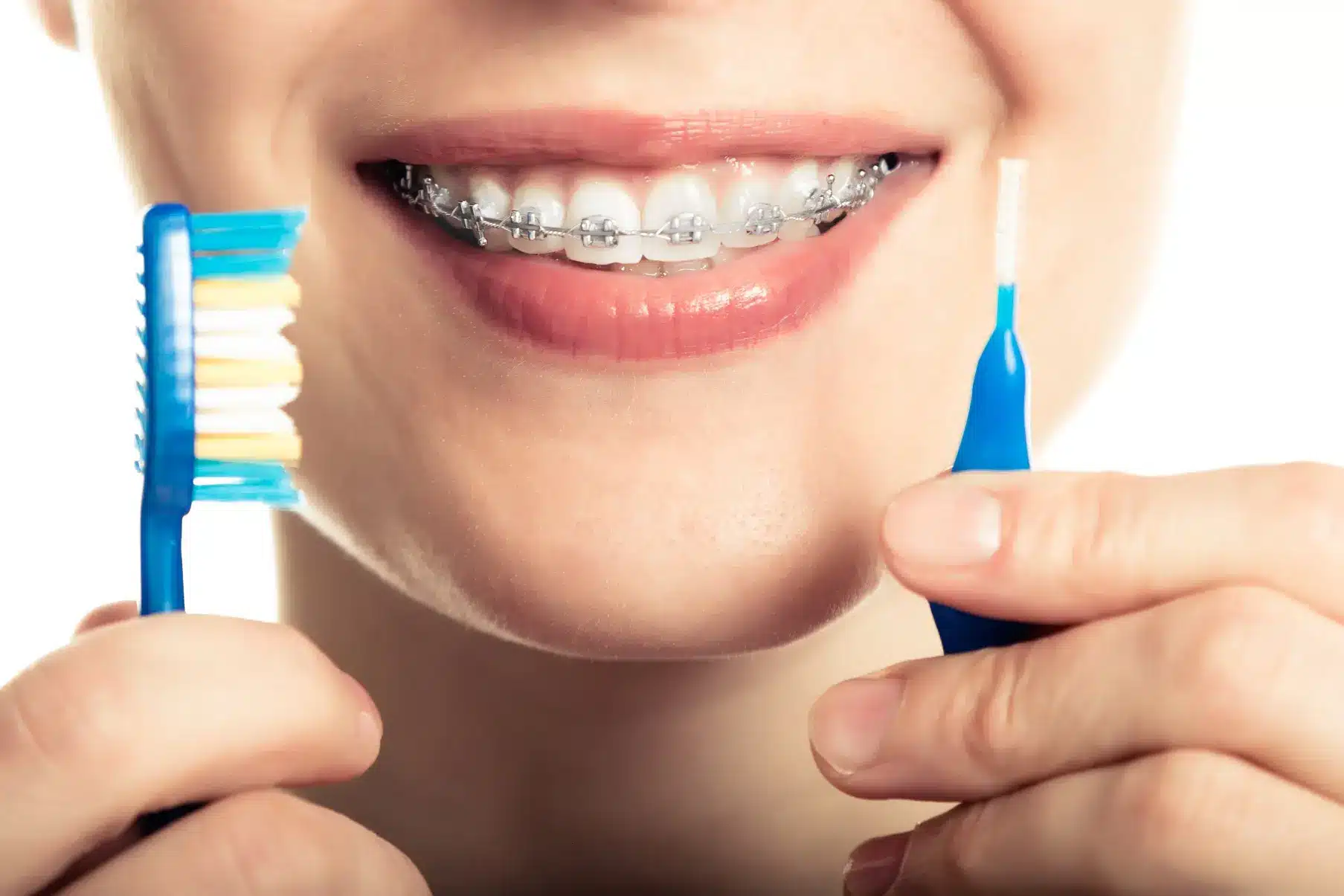 Cientistas revelam ligacao entre escovar dentes e demencia